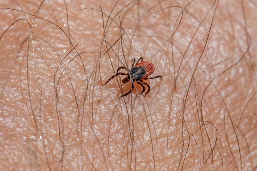 Tick removal