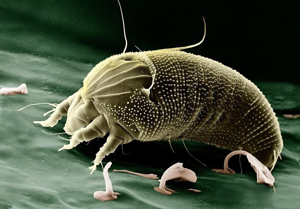 scabies mites
